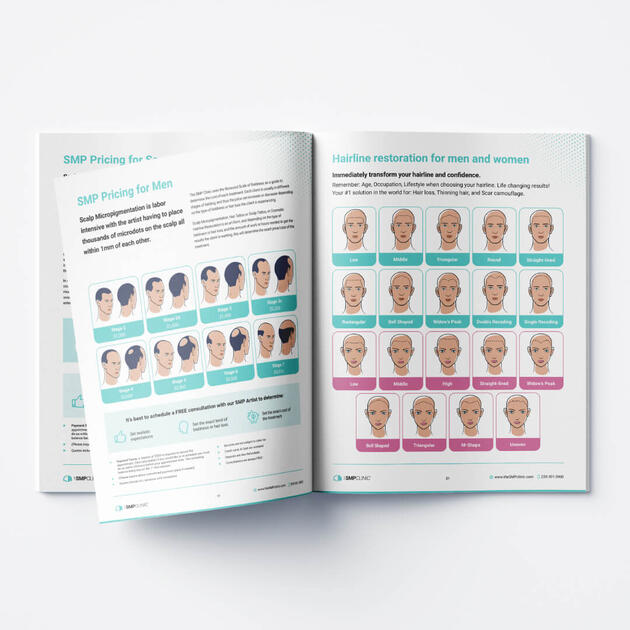 Brochure Design and Baldness Stages Illustrations for SMP Clinic